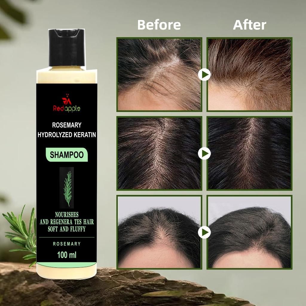Rosemary Hydrolyzed Keratin Shampoo (BUY 1 GET 1 FREE)